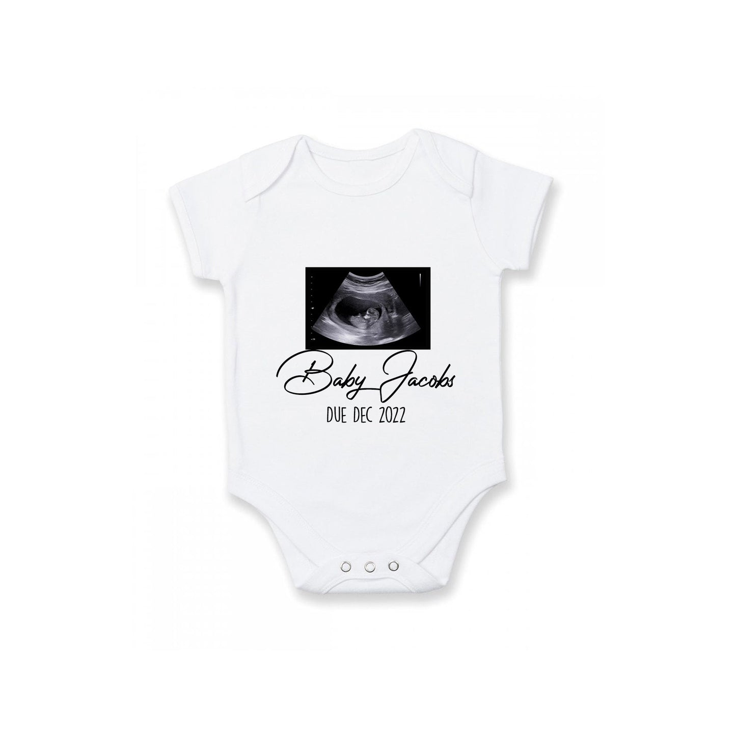 Baby Announcement Baby Grow | Sonogram Picture Gift | 0-3 Months |