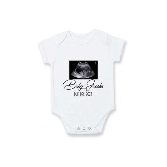 Baby Announcement Baby Grow | Sonogram Picture Gift | 0-3 Months |